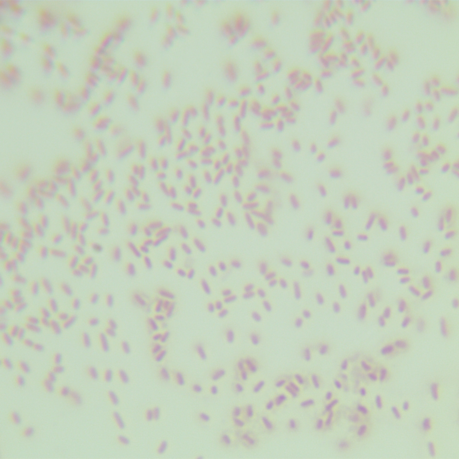 Pseudomonas aeruginosa-BNCC