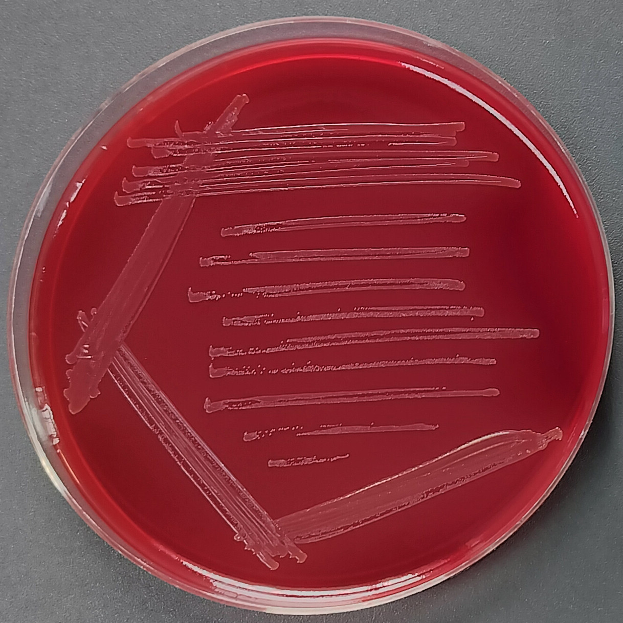 Vaginal Fanny Hesse bacteria-BNCC