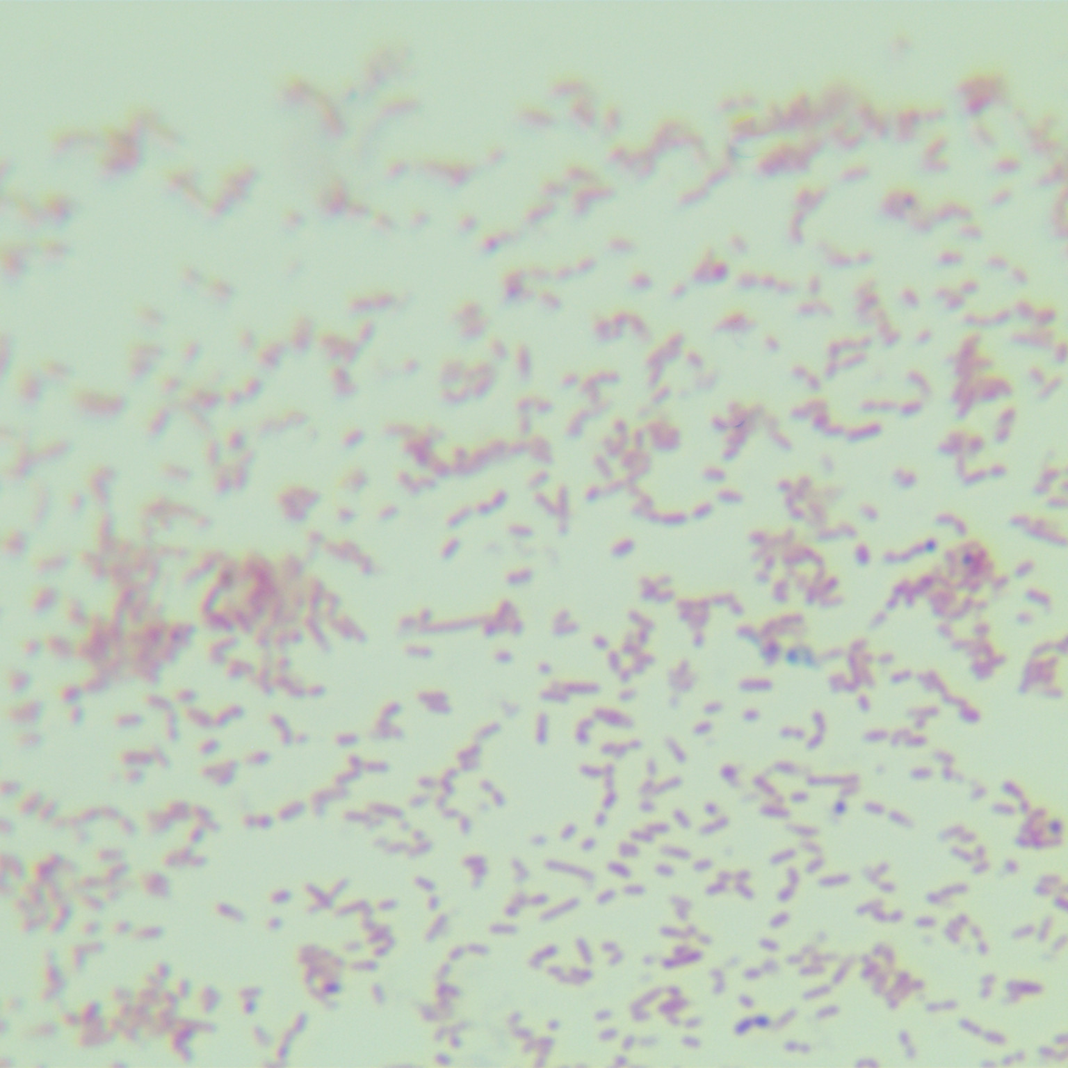Vaginal Fanny Hesse bacteria-BNCC