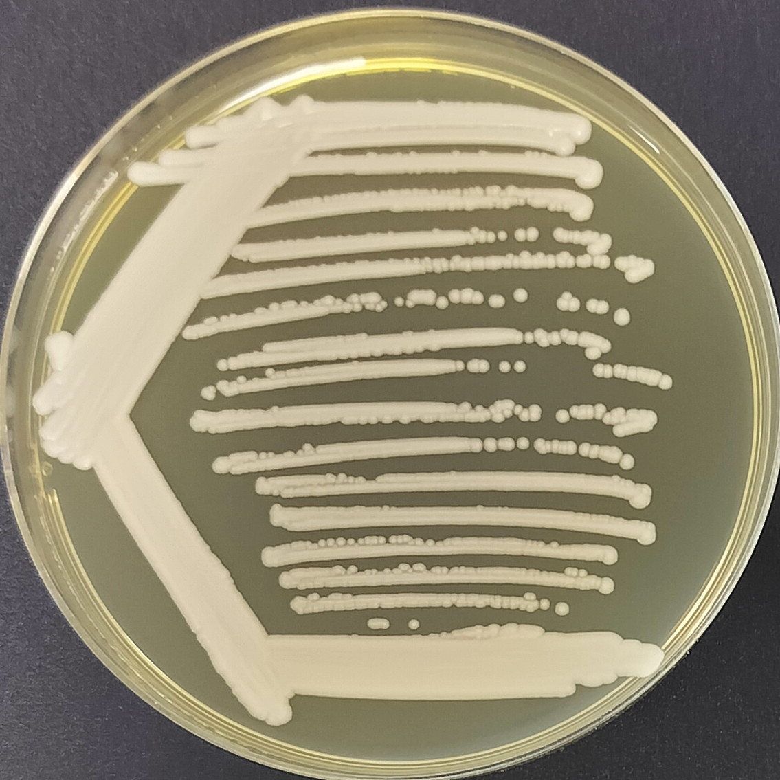 Hansde Pasteurella yeast-BNCC