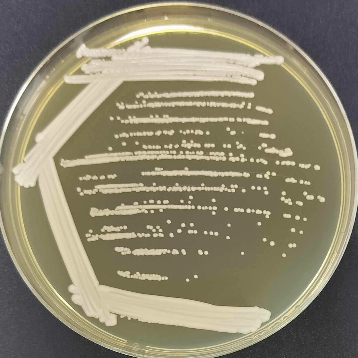 Hansde Pasteurella yeast-BNCC