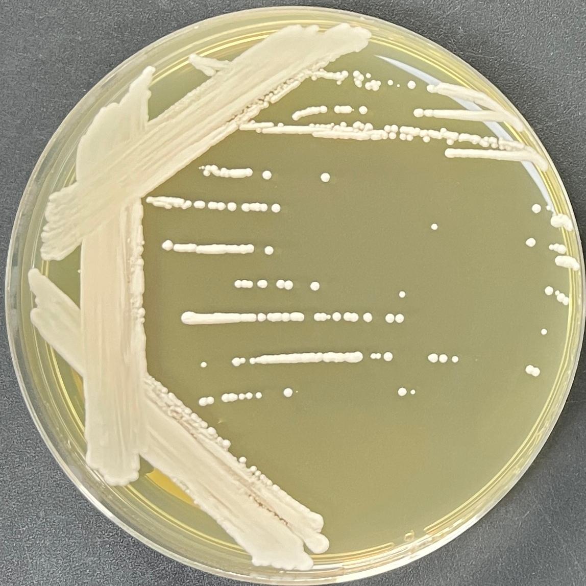 Cyberlindner saturnus-BNCC