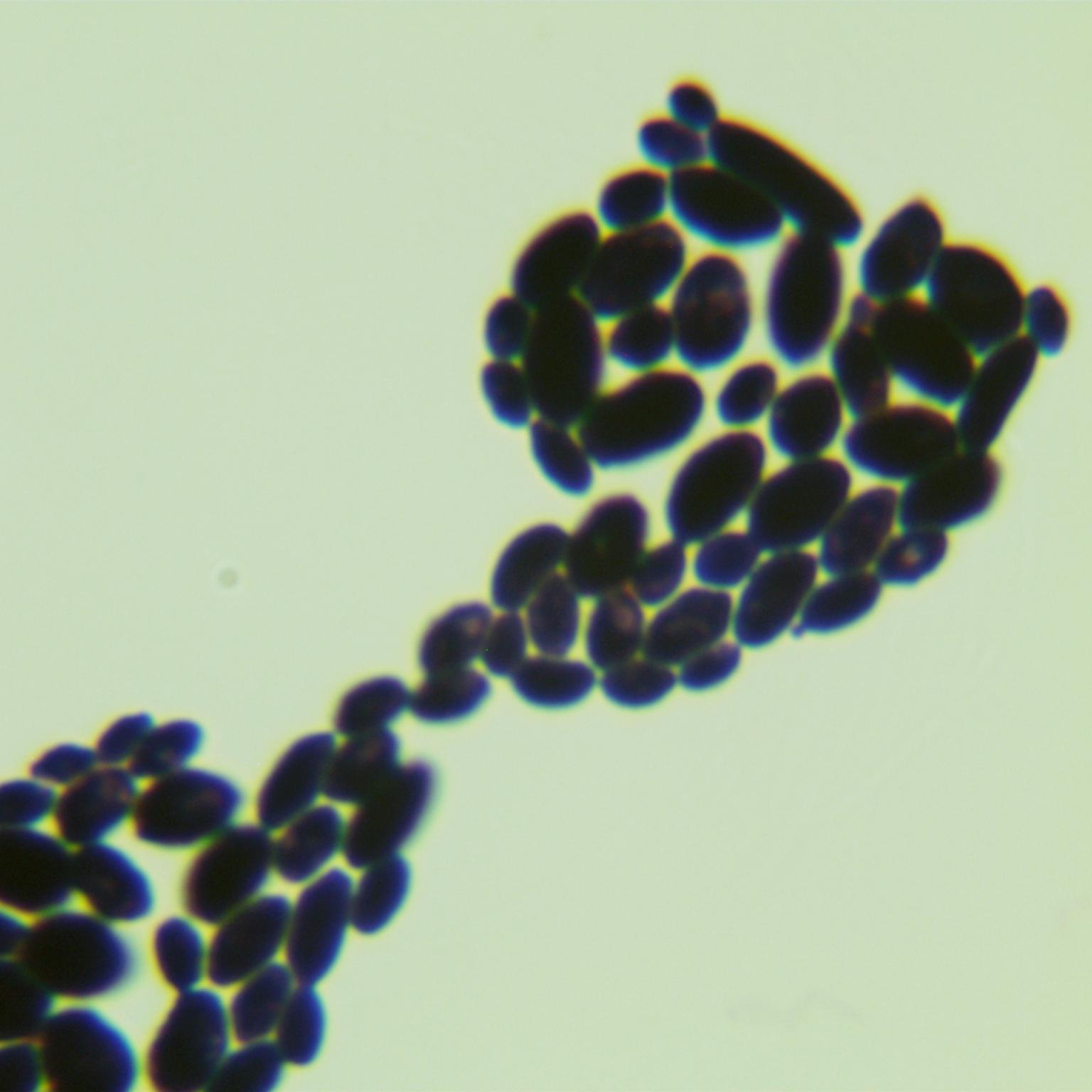 Cyberlindner saturnus-BNCC