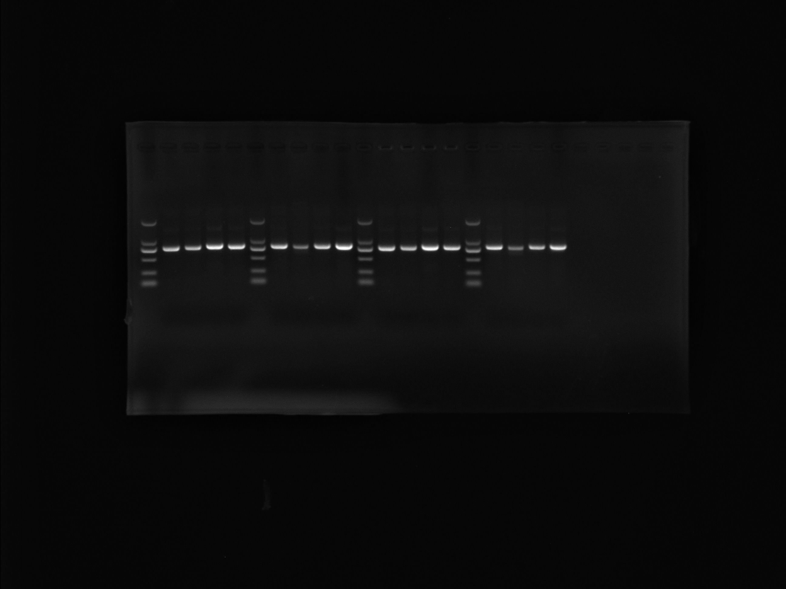 Human papillomavirus type 33 (HPV33) whole genome DNA standard-BNCC