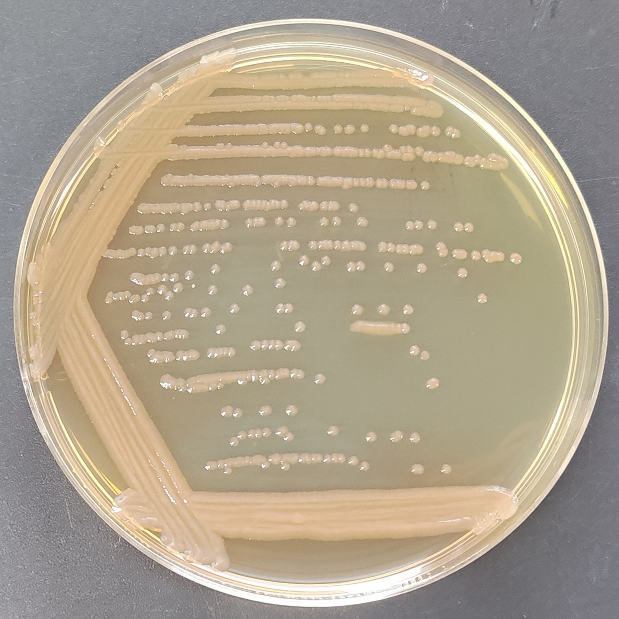 Pseudomonas aeruginosa-BNCC