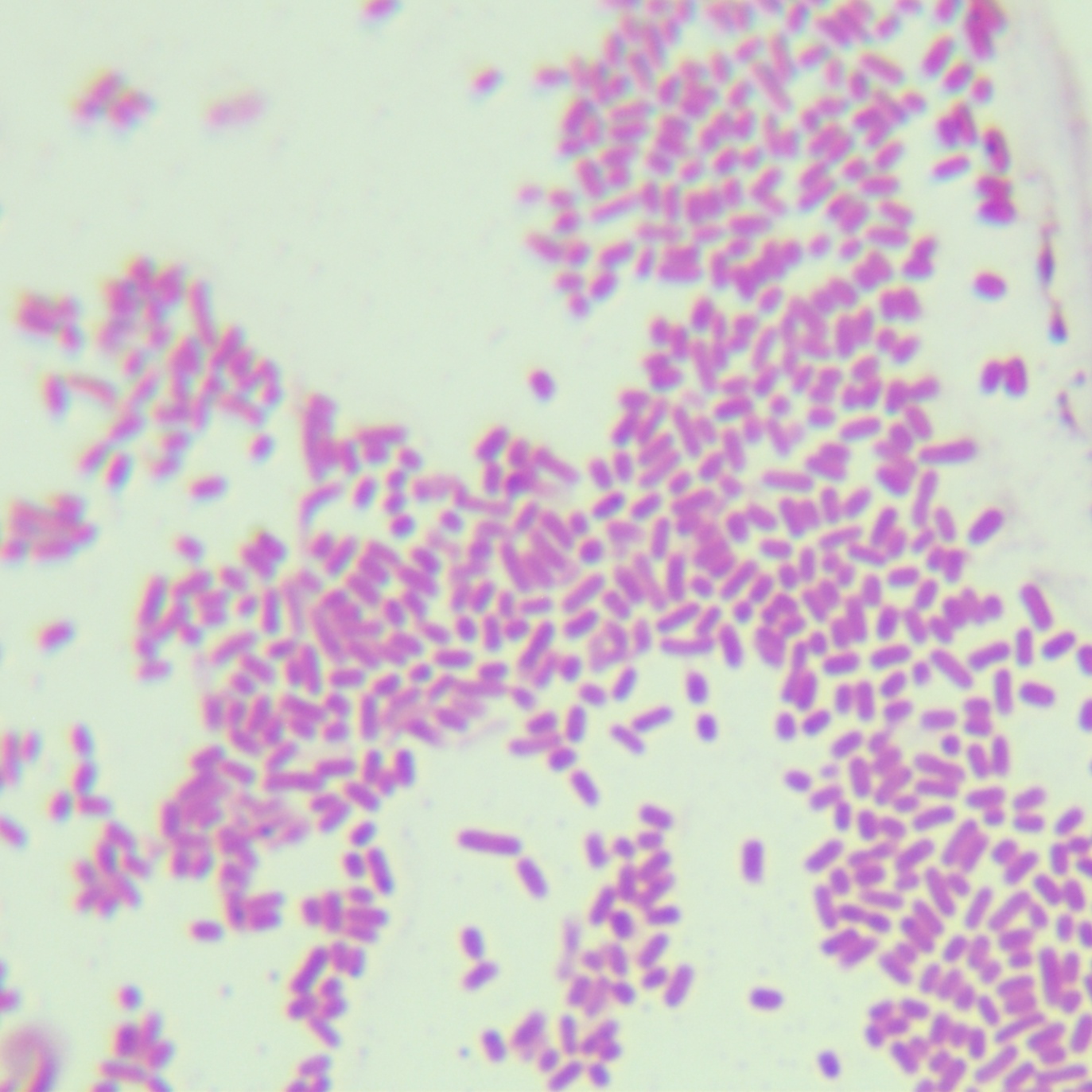 W3110 (DE3) Escherichia coli-BNCC
