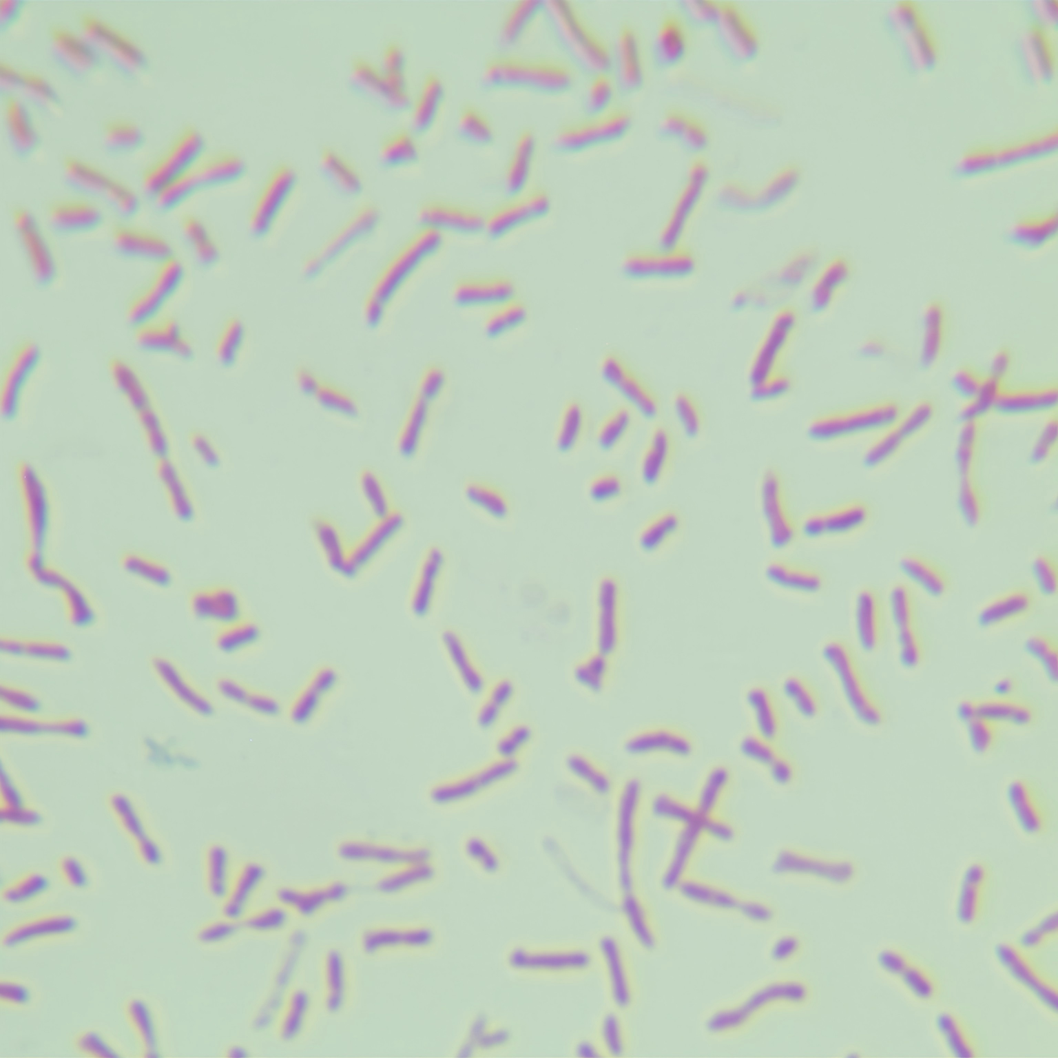 Neosphingomonas aeruginosa-BNCC