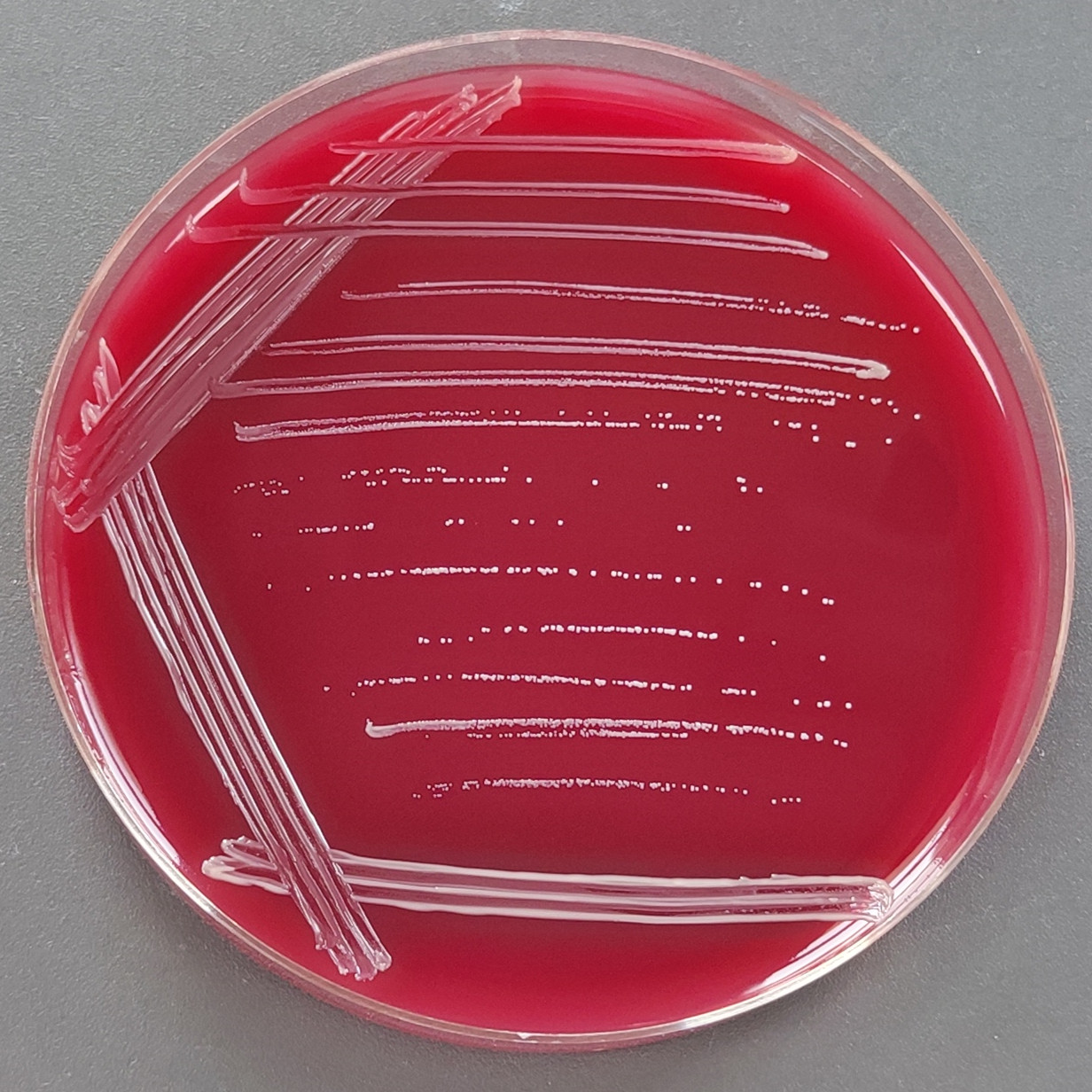 Propionibacterium acnes (Propionibacterium acnes, Propionibacterium acnes)-BNCC