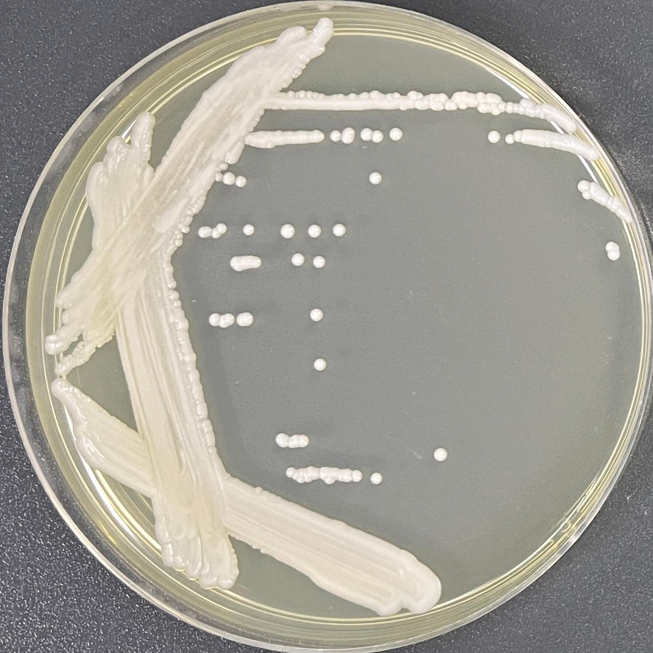 Spoon shaped yeast-BNCC