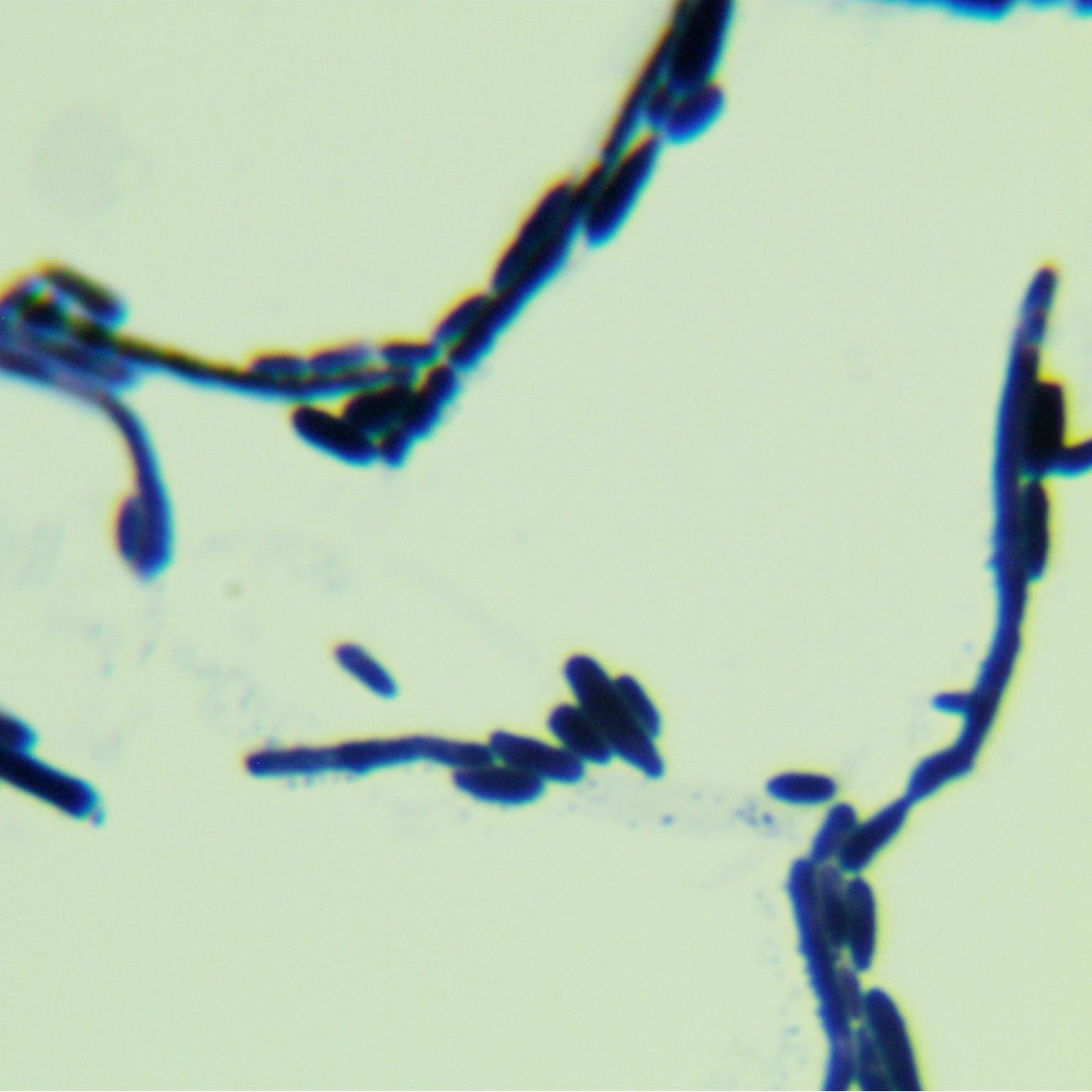 Fake Isabella yeast-BNCC
