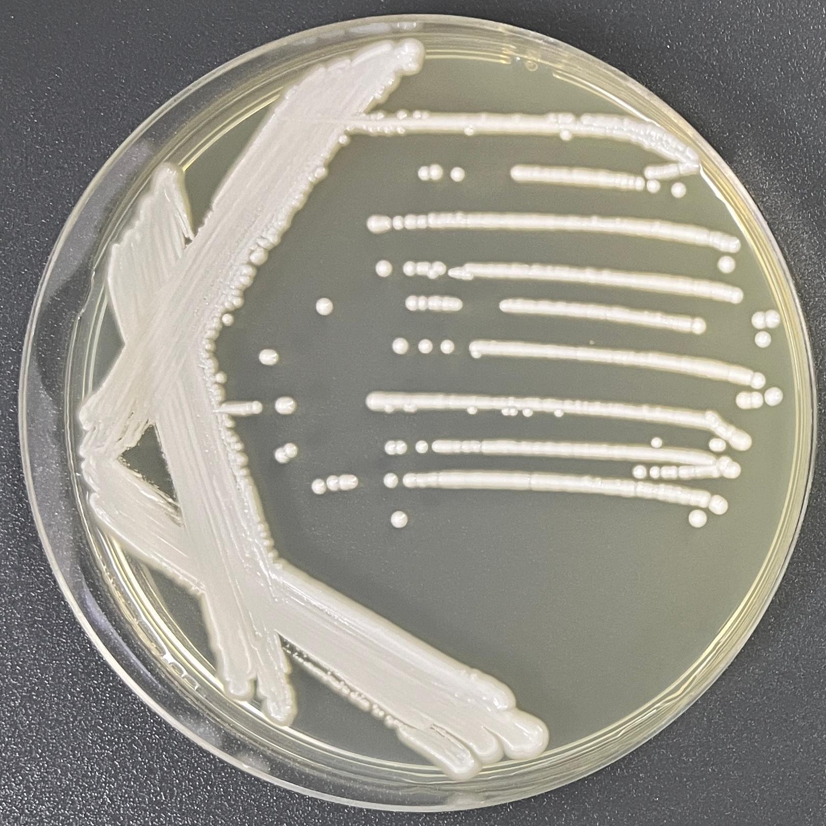 Cylindner yeast-BNCC