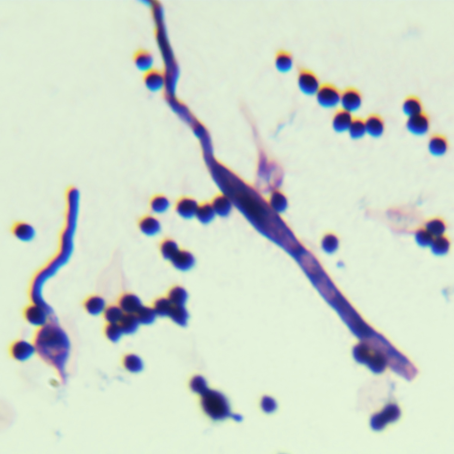 Botrytis cinerea-BNCC