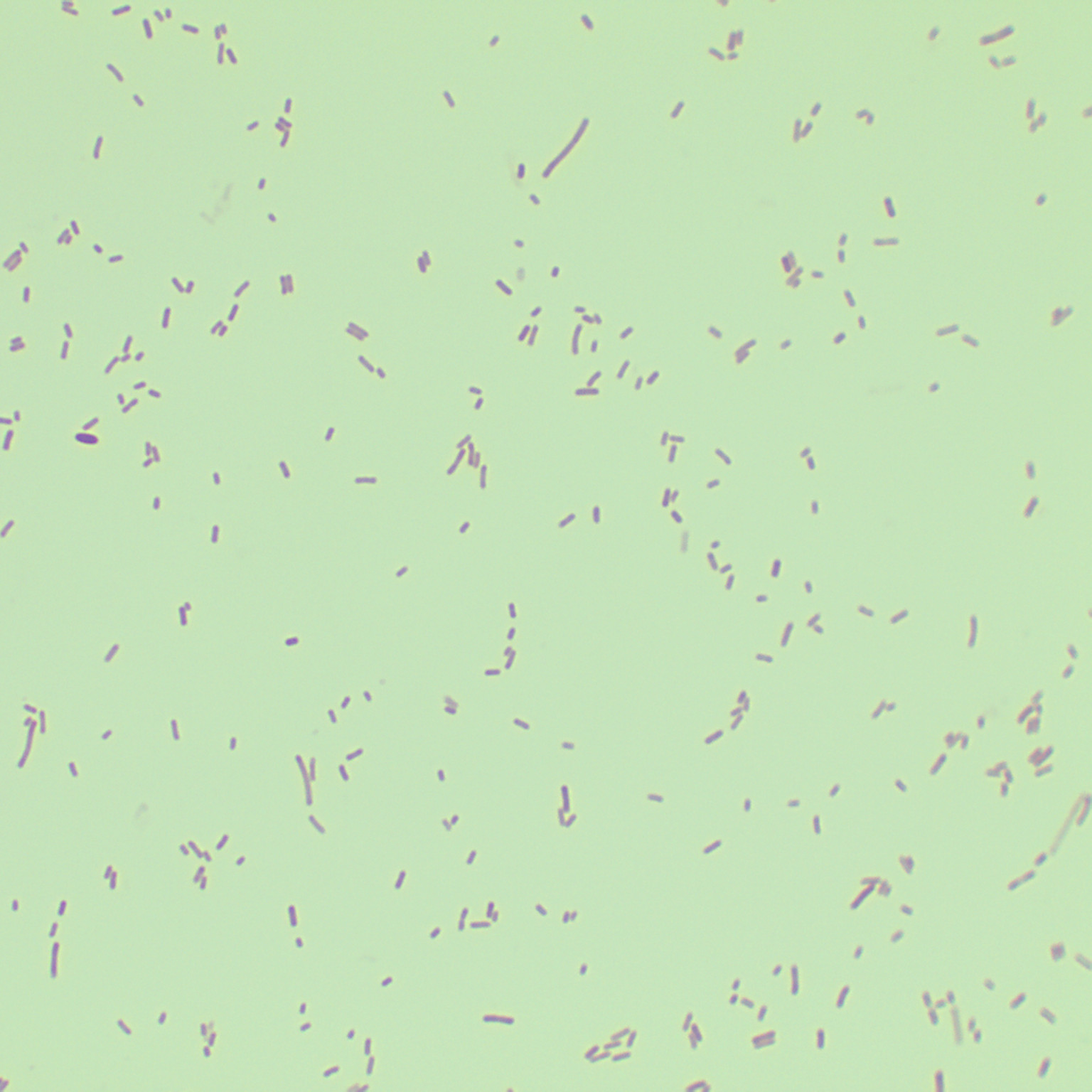 Lemo21 (DE3) Escherichia coli-BNCC