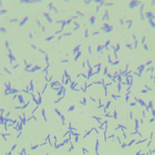 Picky snail fungus-BNCC