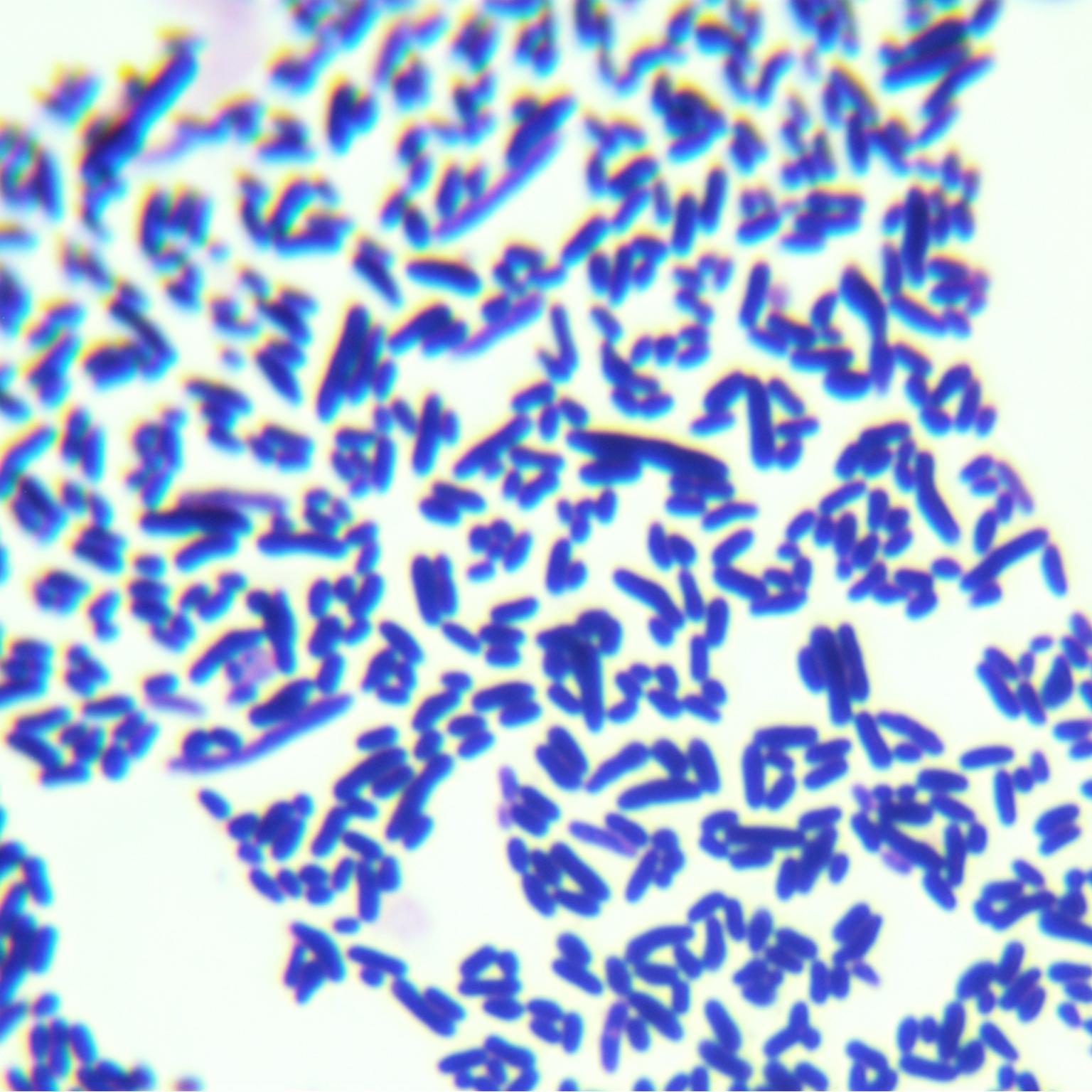 Corynebacterium glutamicum-BNCC