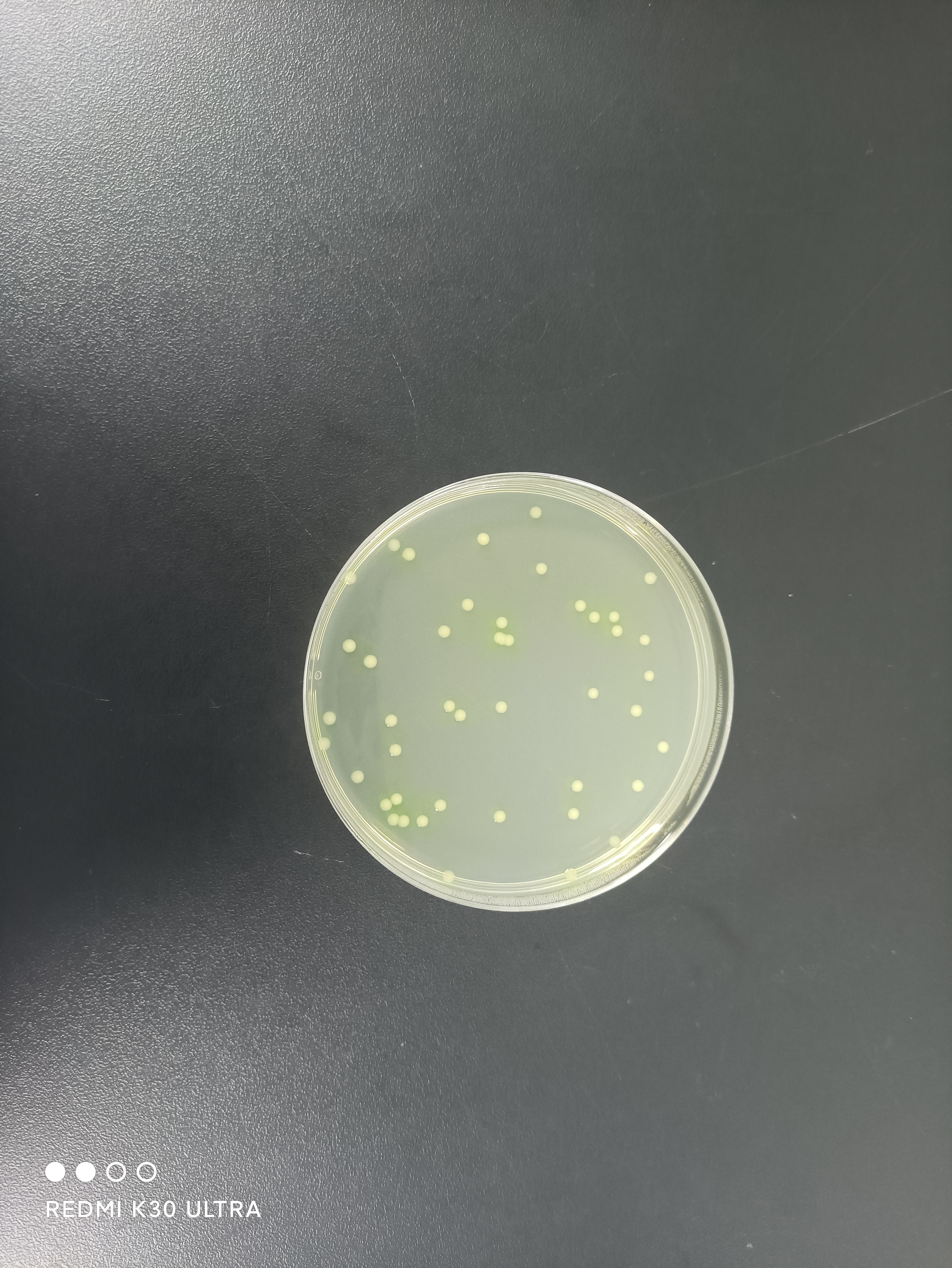 Quality Control Sample for Pseudomonas aeruginosa in Single-Use Sanitary Products-BNCC