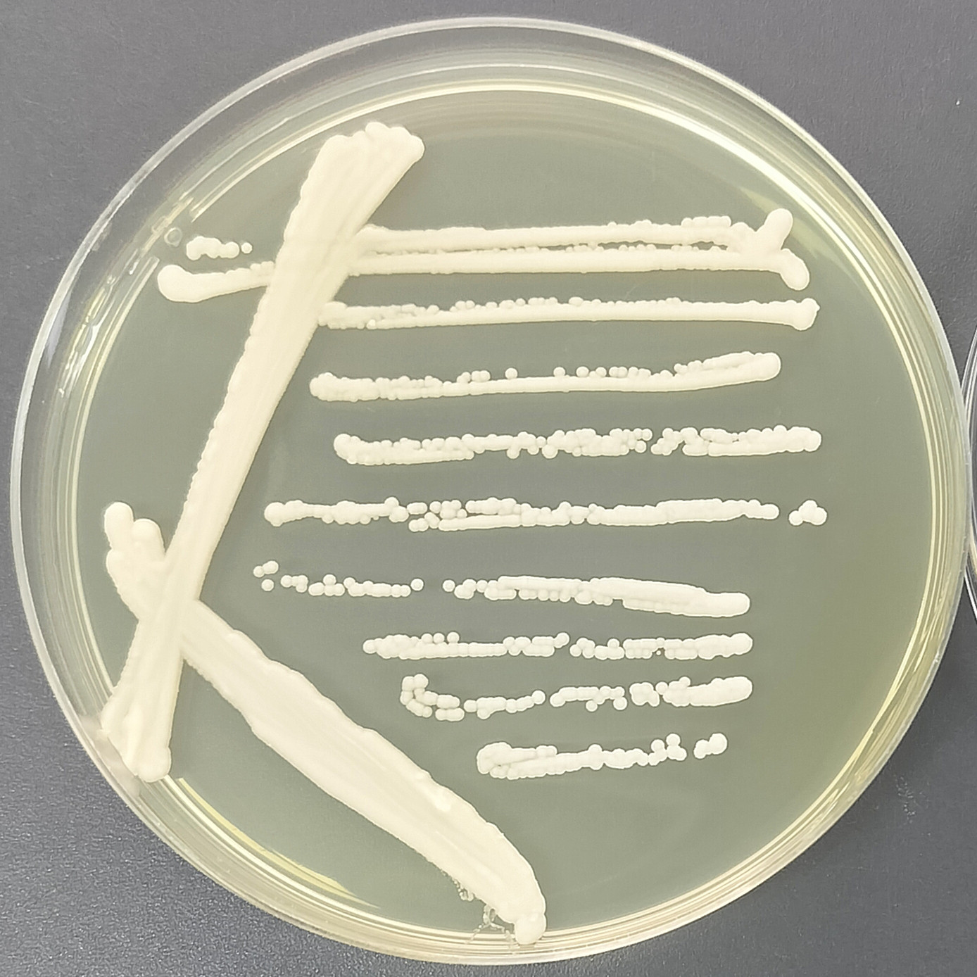 Saccharomyces cerevisiae-BNCC