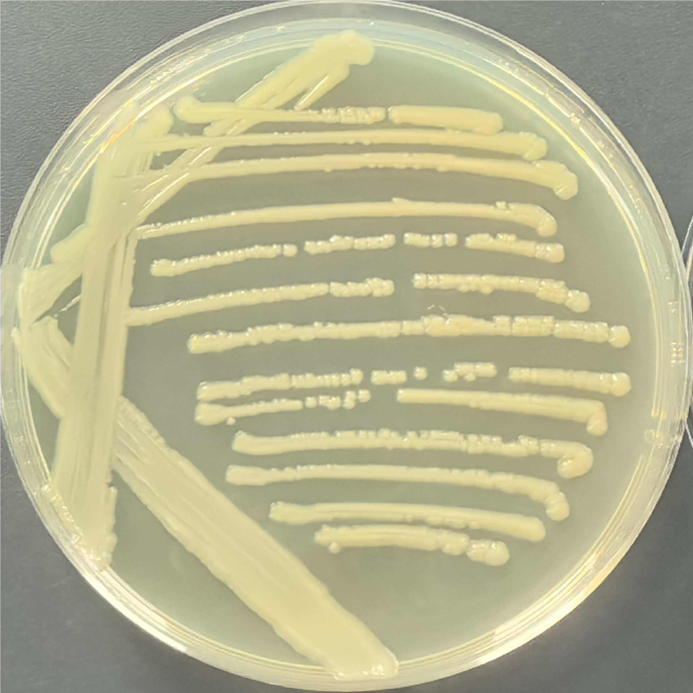 Escherichia coli-BNCC