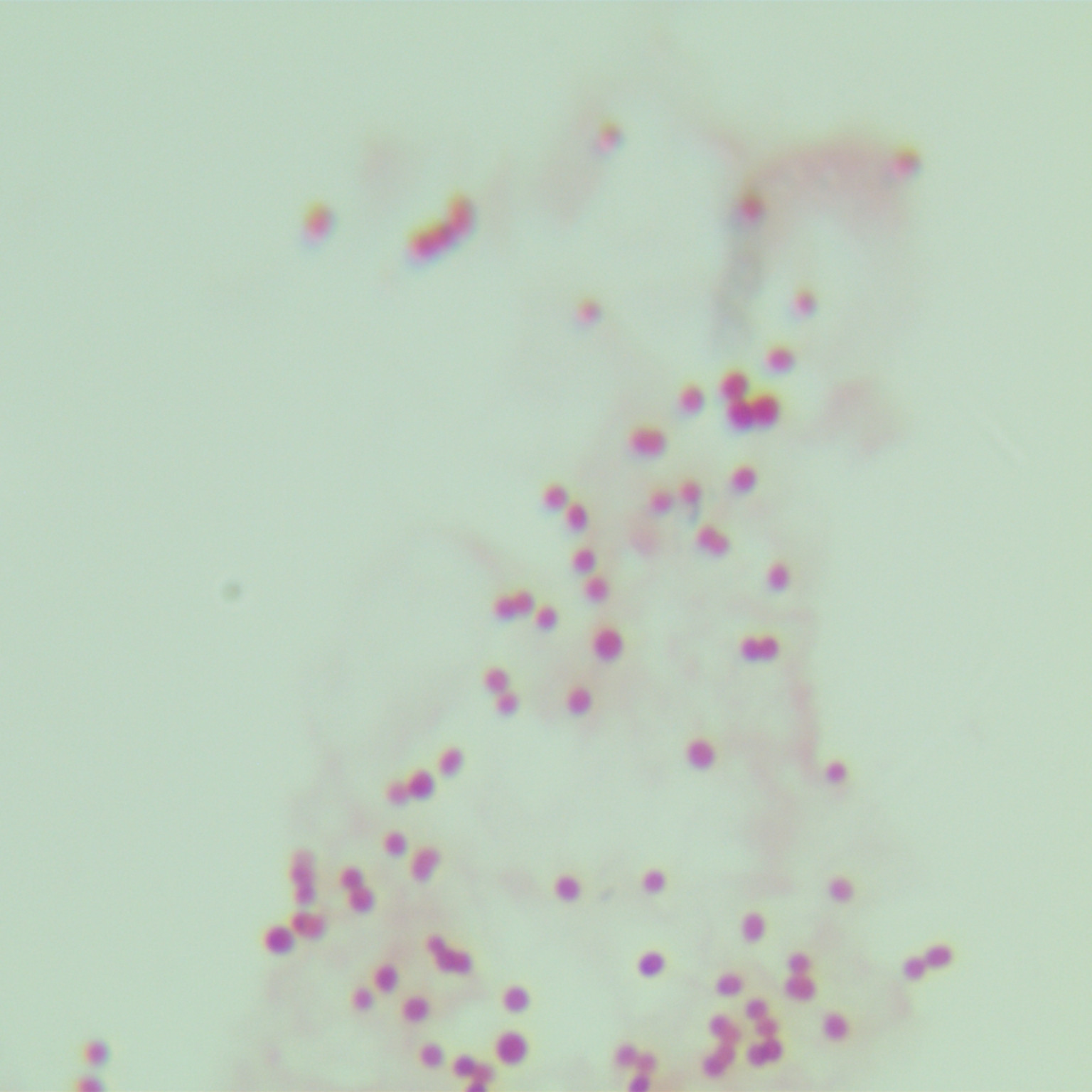Fecal psychrophilic bacteria-BNCC