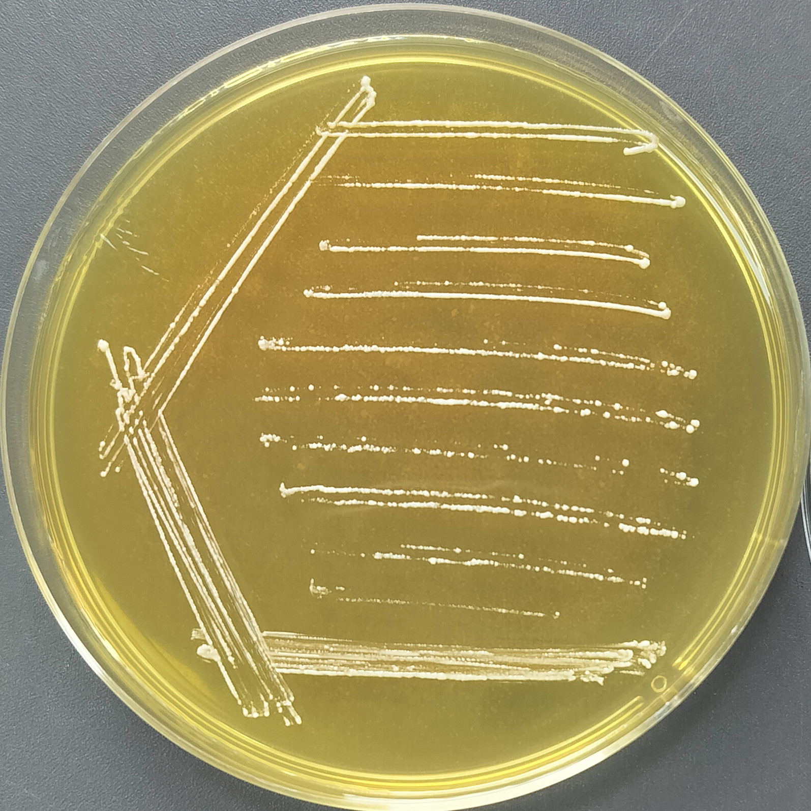 Long subspecies of Bifidobacterium longum-BNCC