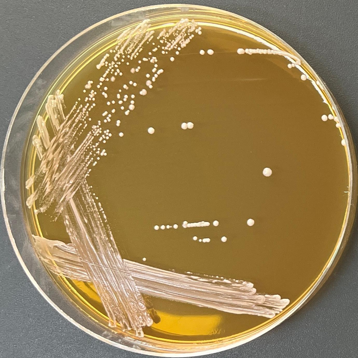 Lactobacillus fermentum-BNCC
