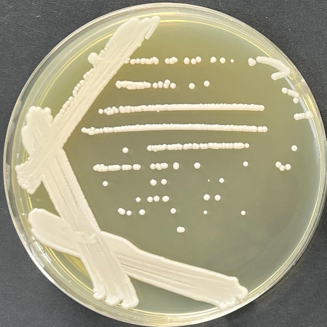 Xiaguan Shanshan yeast-BNCC