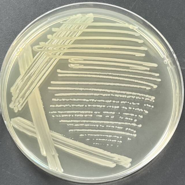 Shigella dysentery-BNCC