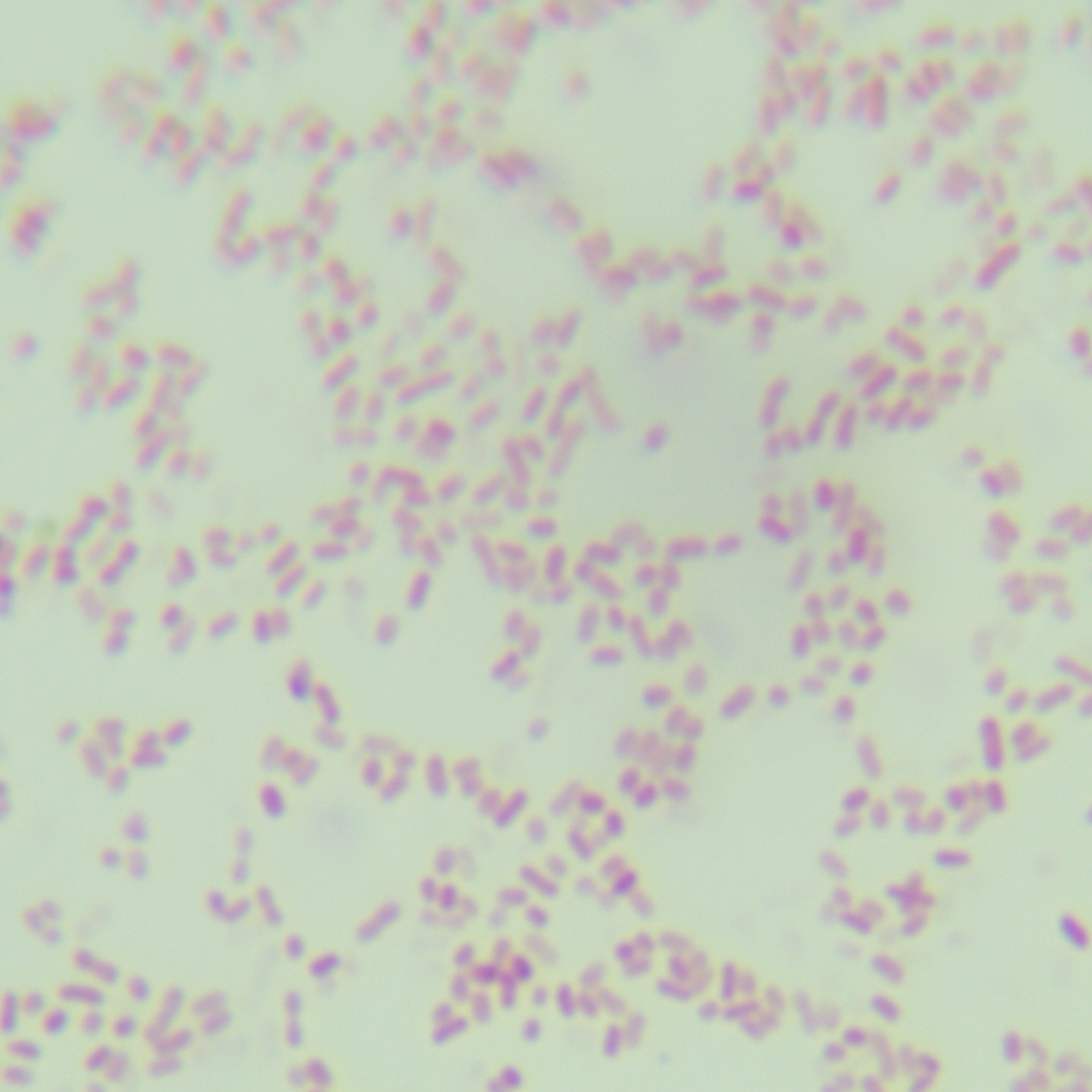 Shigella dysentery-BNCC
