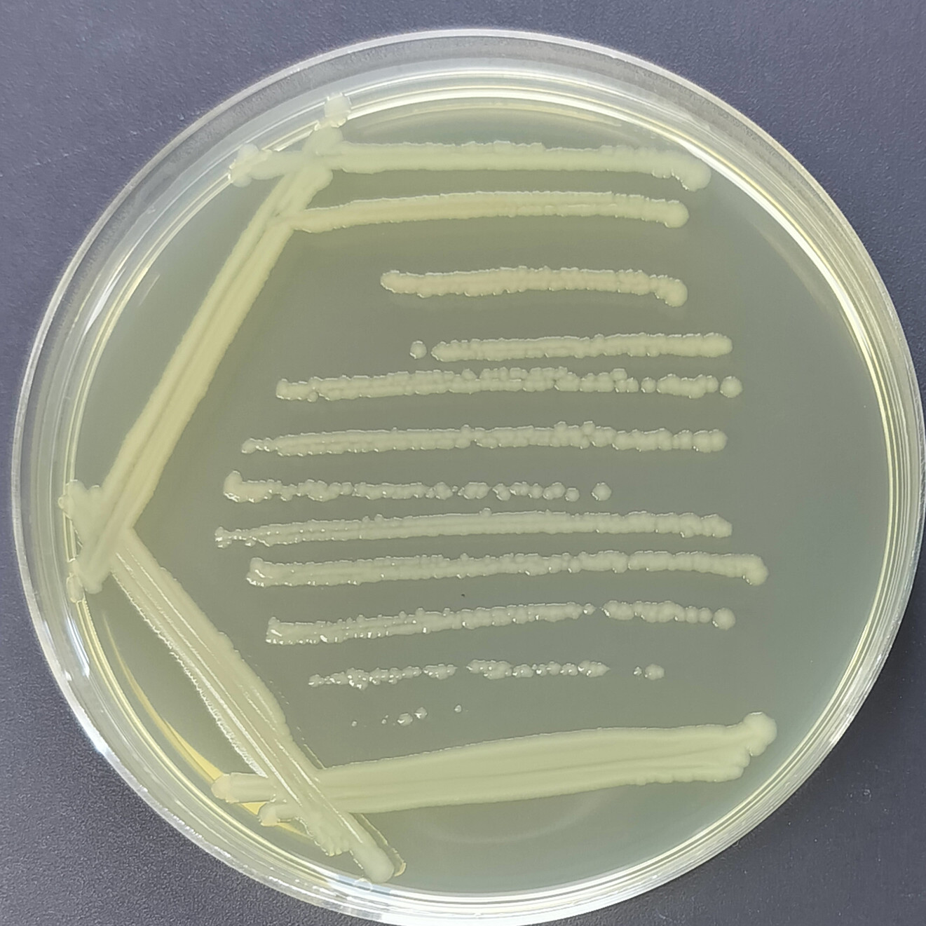 Escherichia coli-BNCC