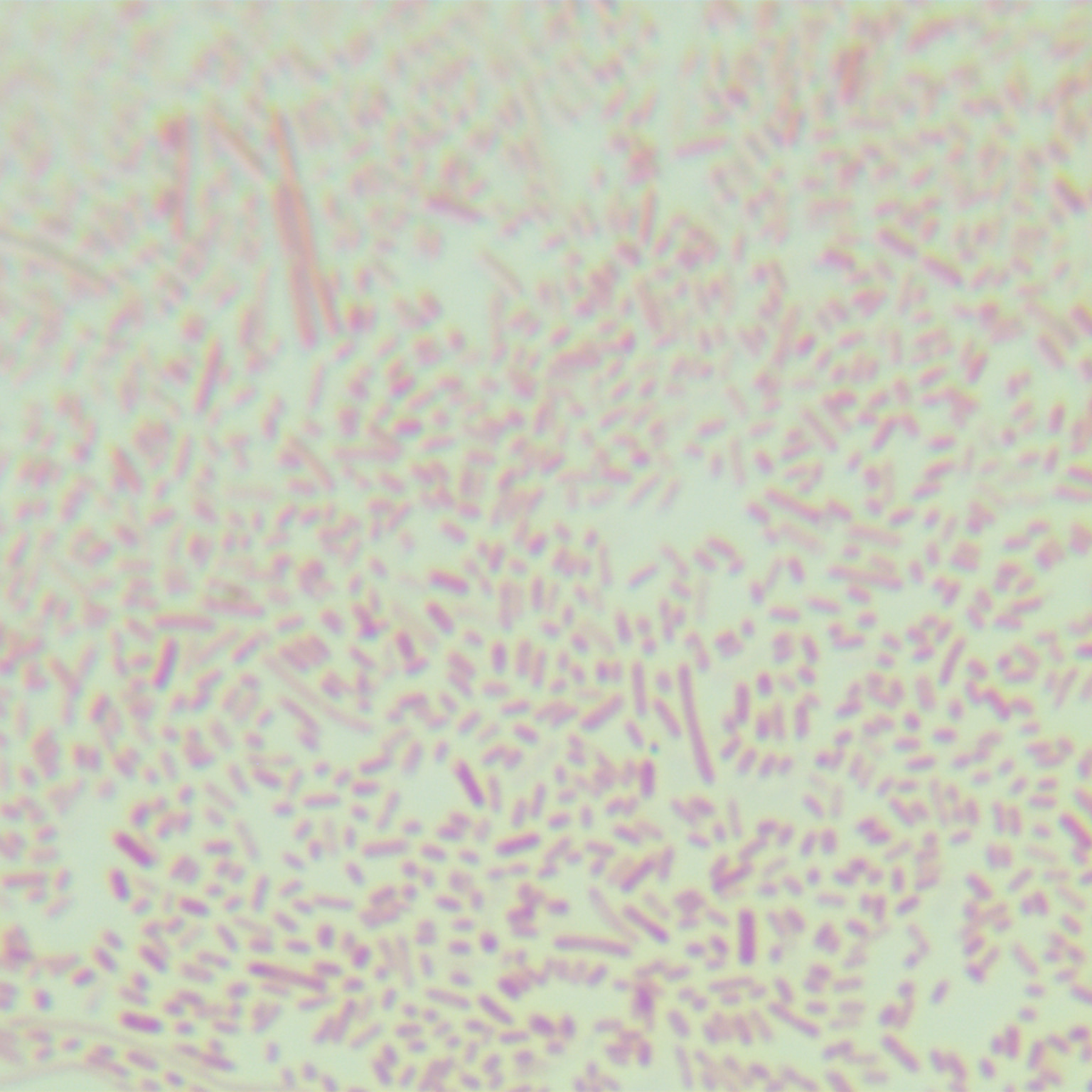 Escherichia coli-BNCC
