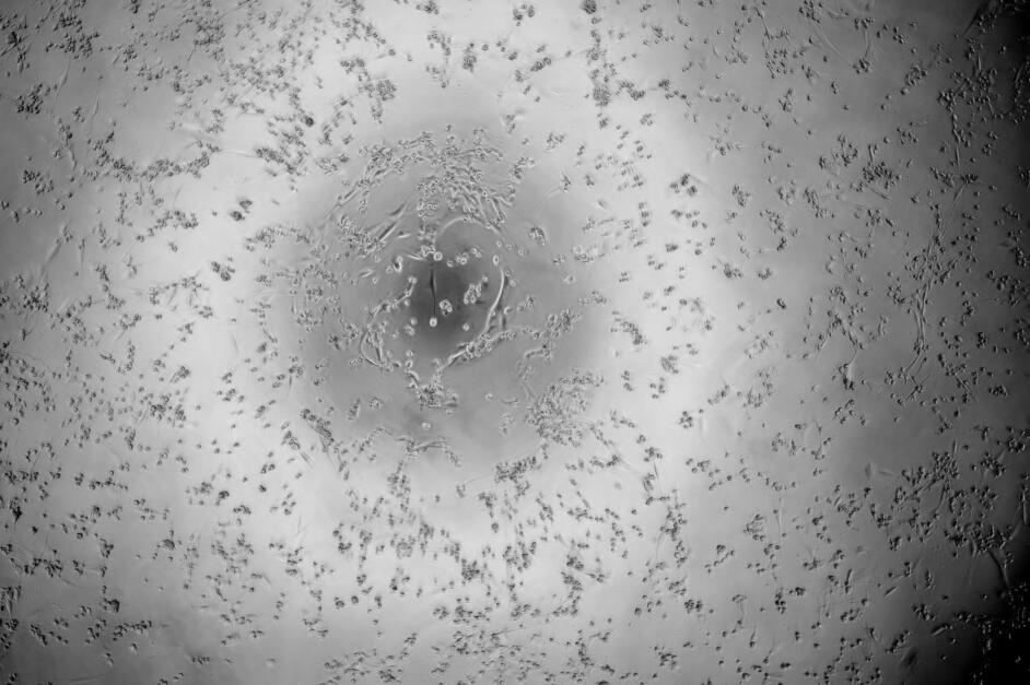 Feline Immunodeficiency Virus-BNCC