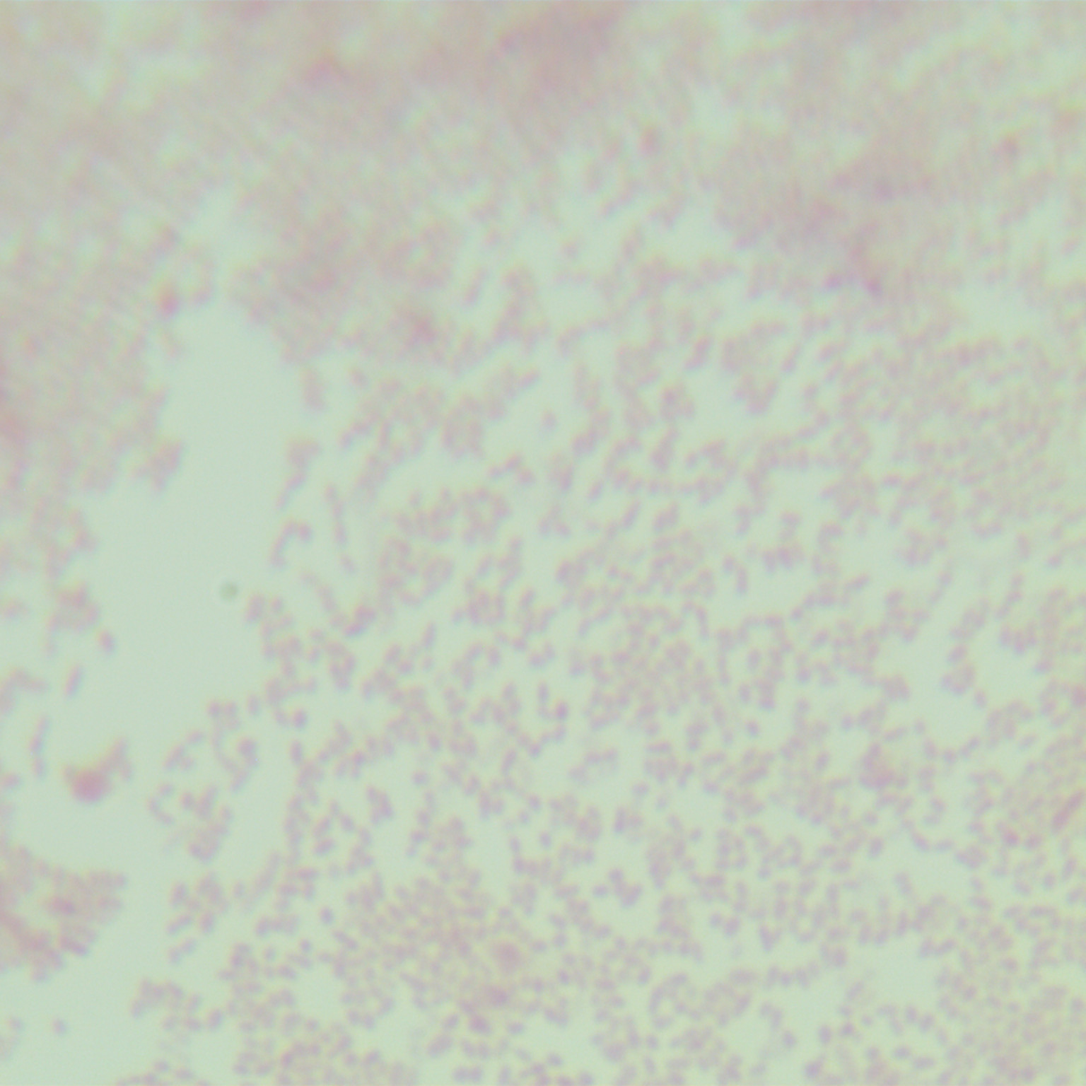 Brucella (S2 strain)-BNCC