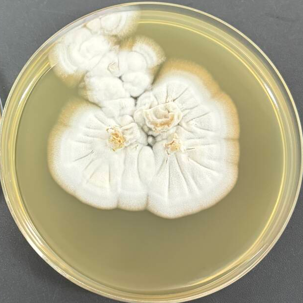 Eastern Pseudomonas aeruginosa-BNCC