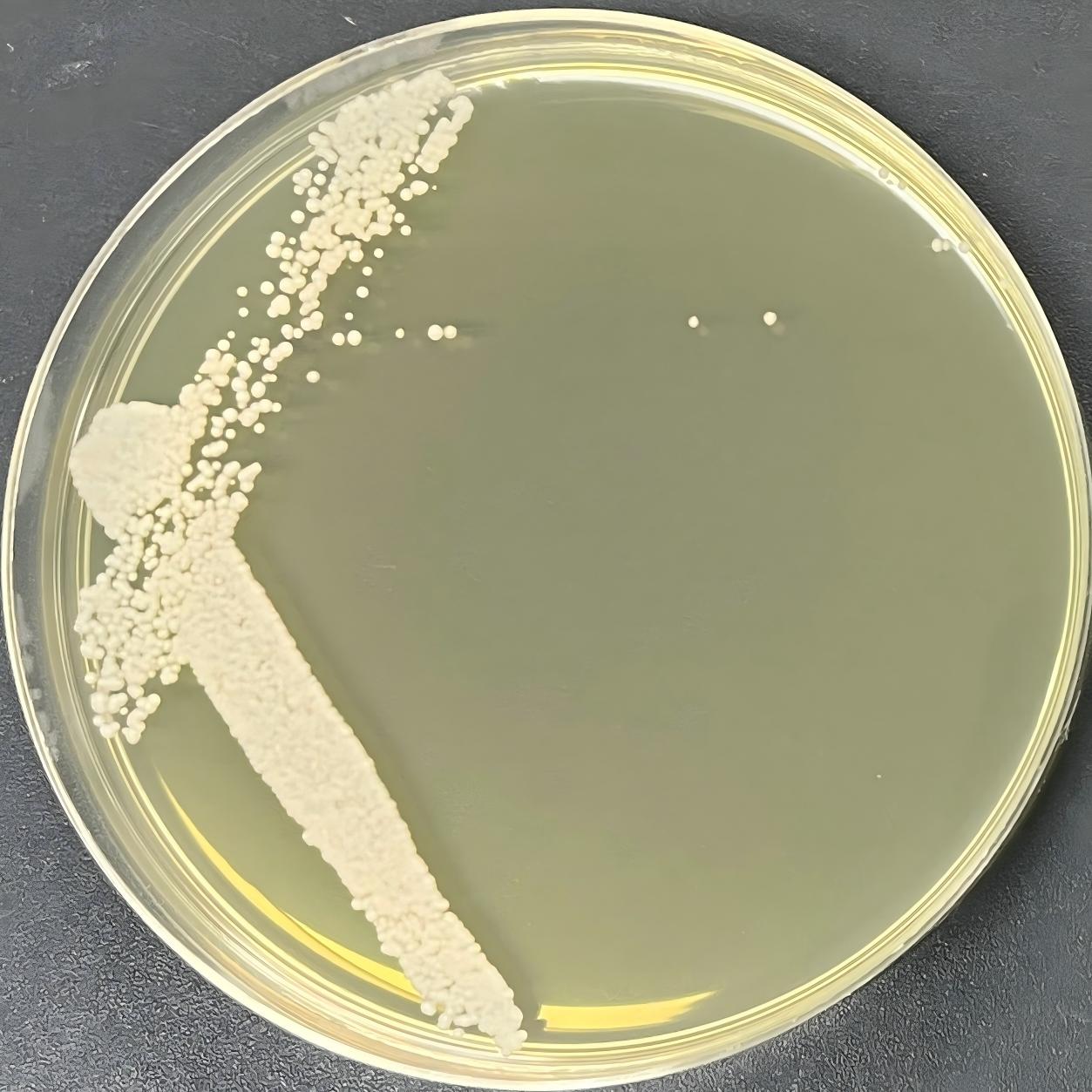Fanlijia yeast in humus soil-BNCC