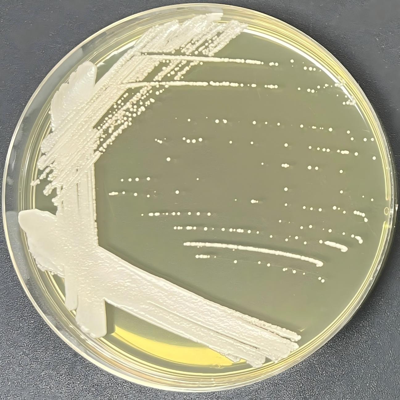 Cylindner yeast-BNCC