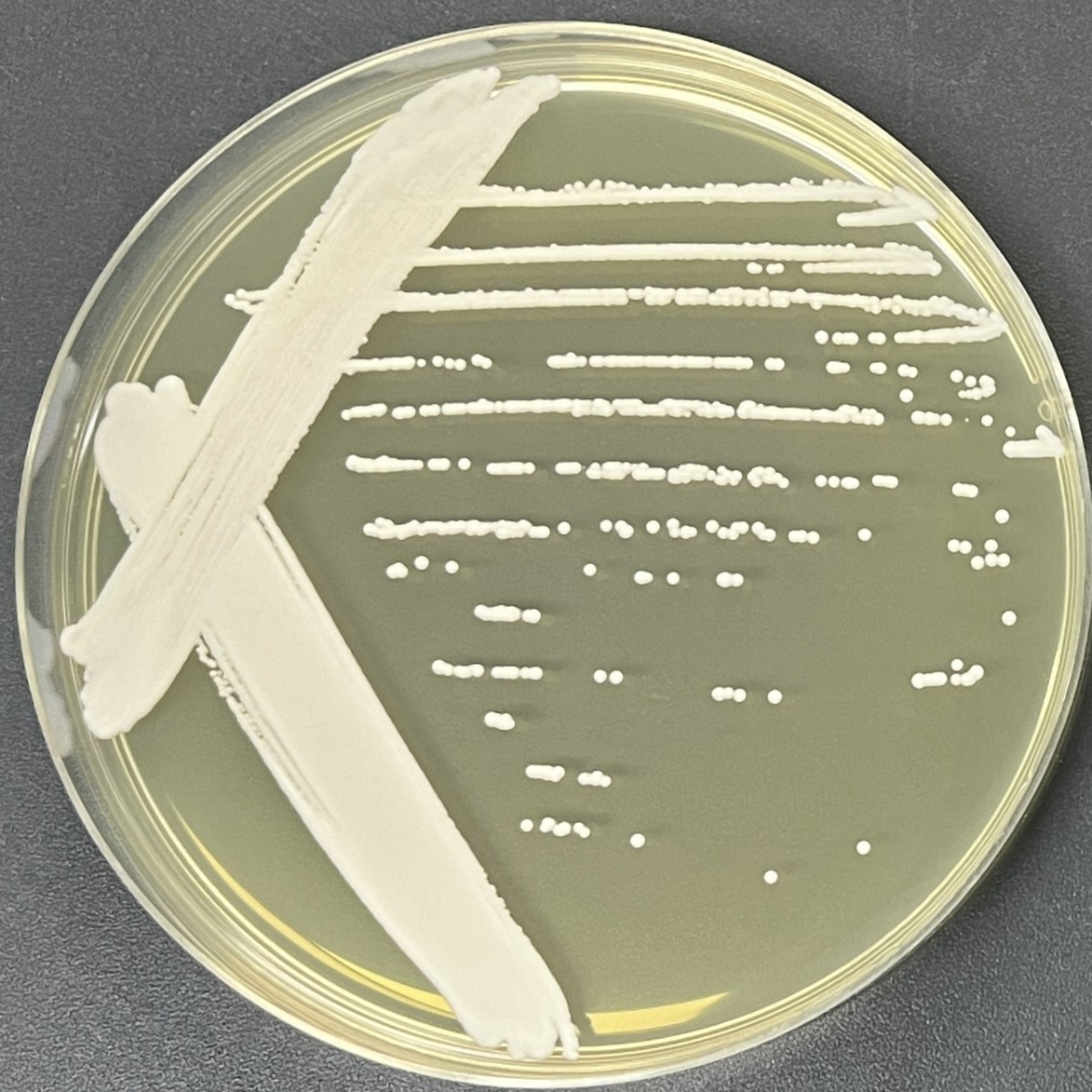 Abnormal Wickham yeast-BNCC