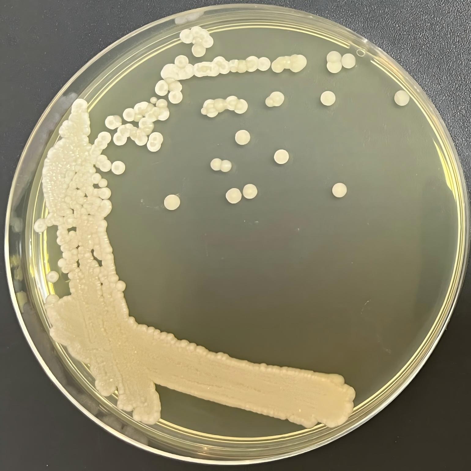 Moss growing Wanshi yeast-BNCC