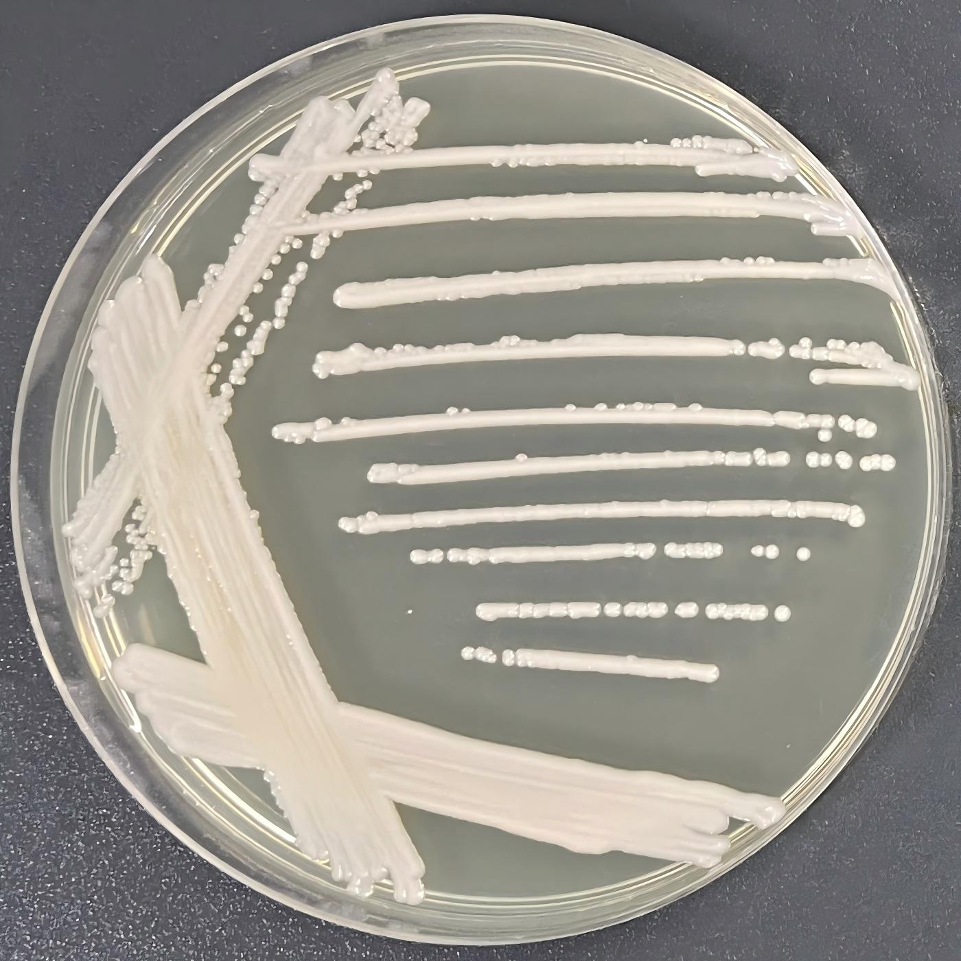 Jiufeng Candida-BNCC