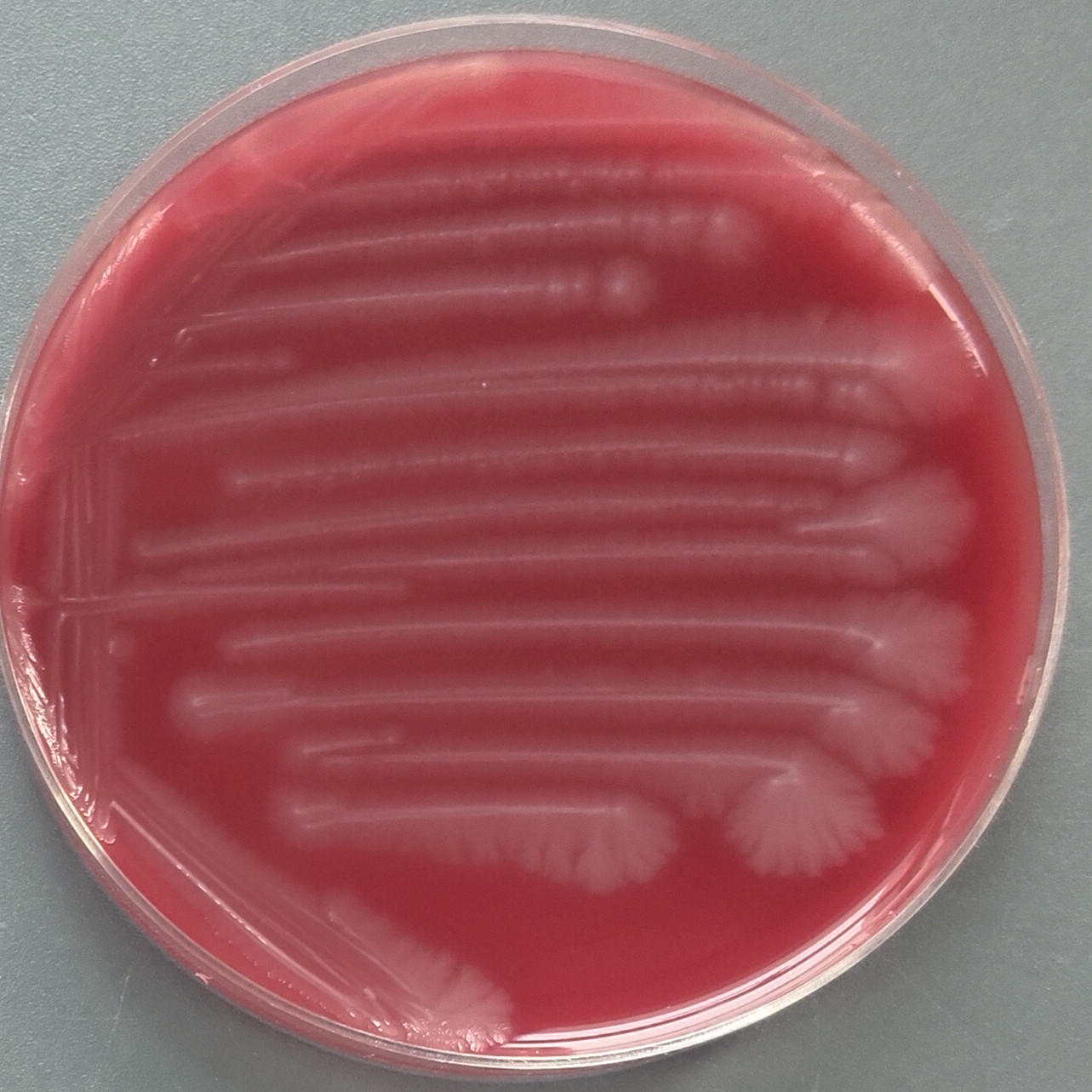 Clostridium perfringens-BNCC