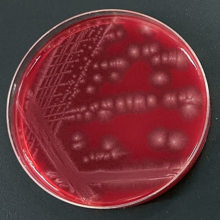 Clostridium perfringens-BNCC
