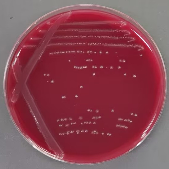 Clostridium perfringens-BNCC