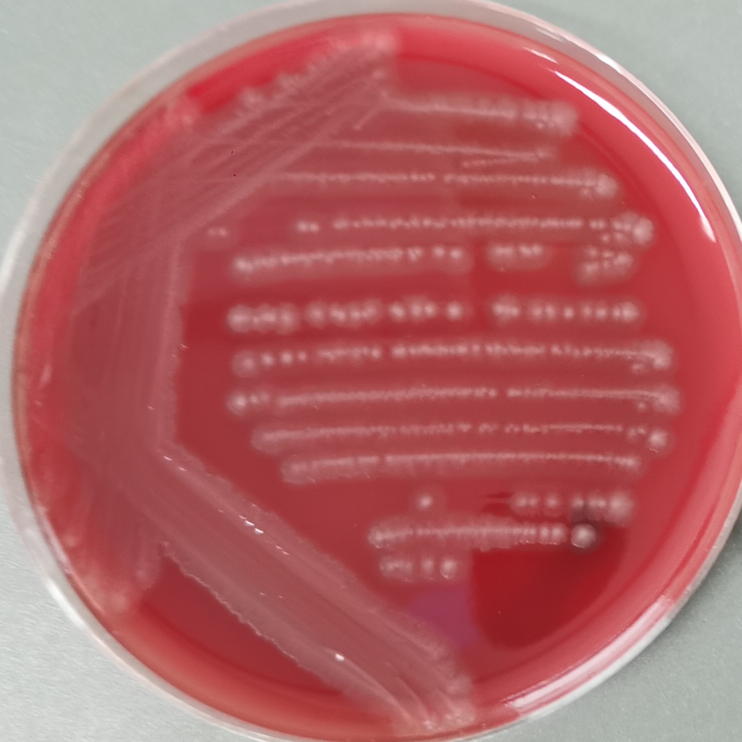 Clostridium perfringens-BNCC