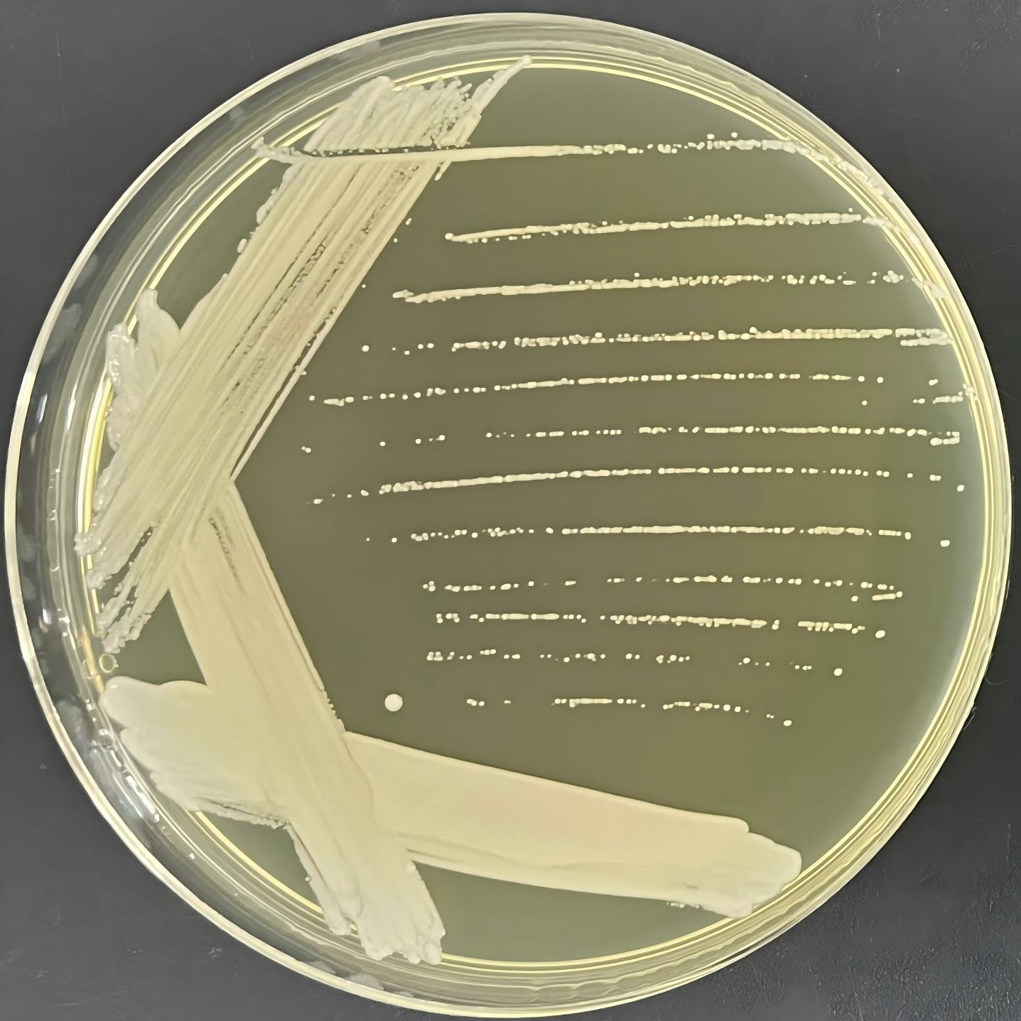 Succinate loving Candida-BNCC