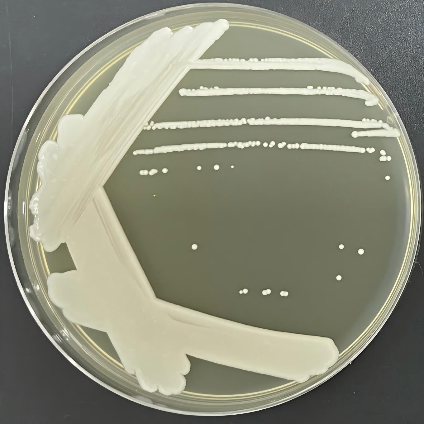 Succinate loving Candida-BNCC