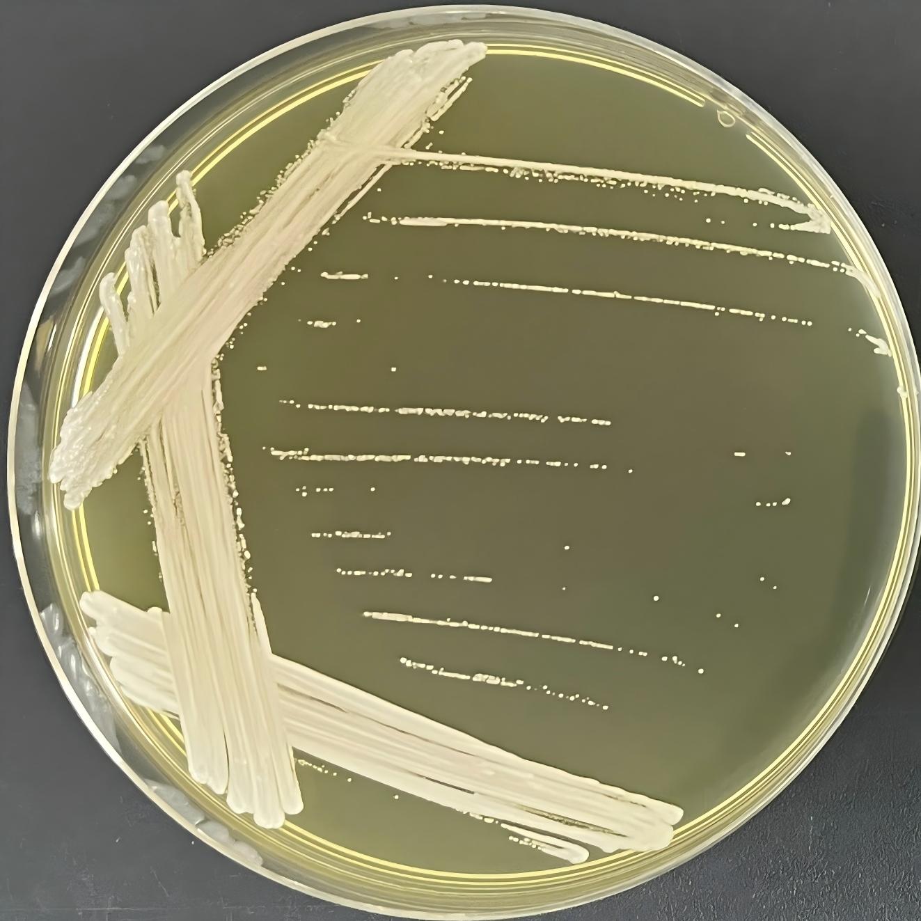 Succinate loving Candida-BNCC