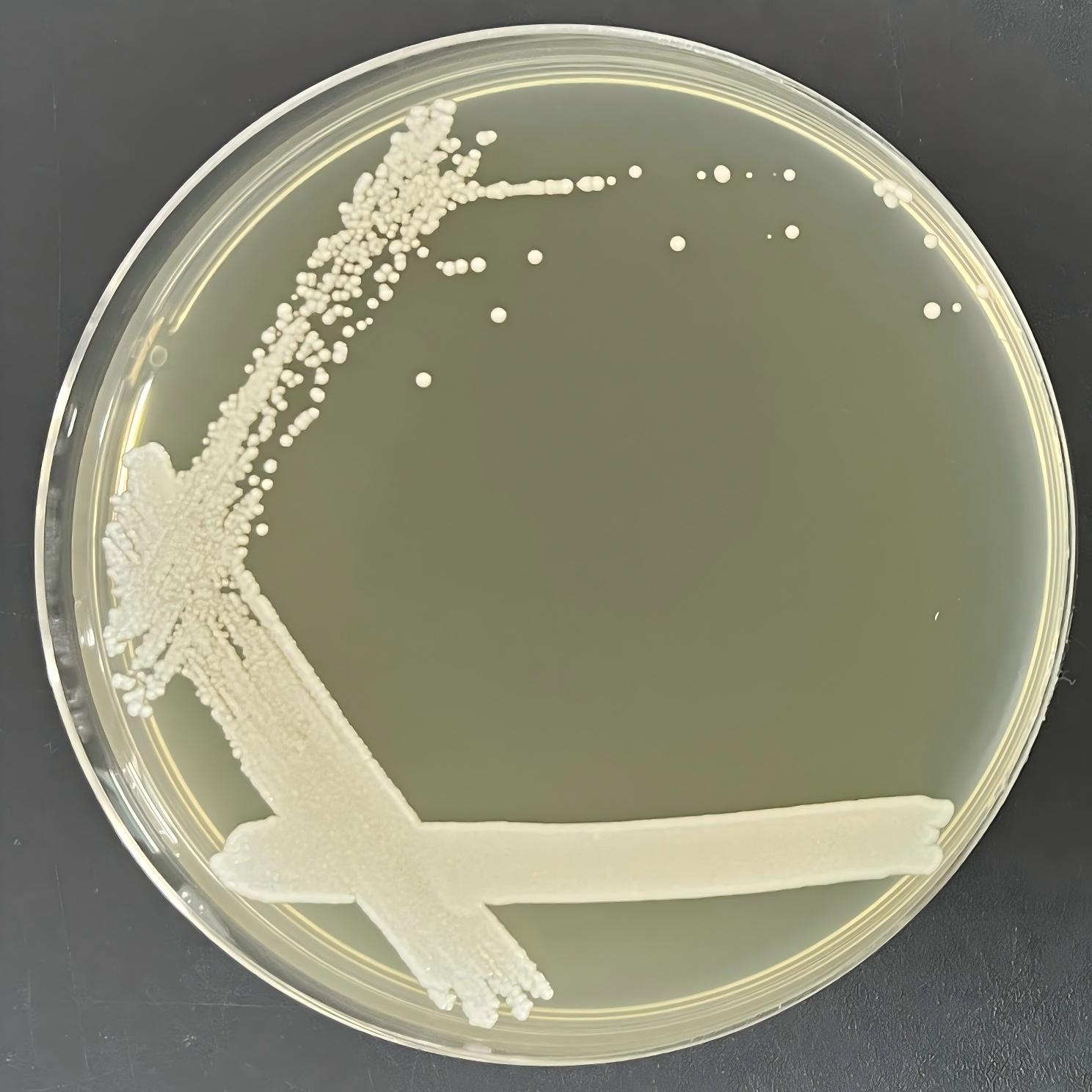 Du's Kluwei yeast-BNCC