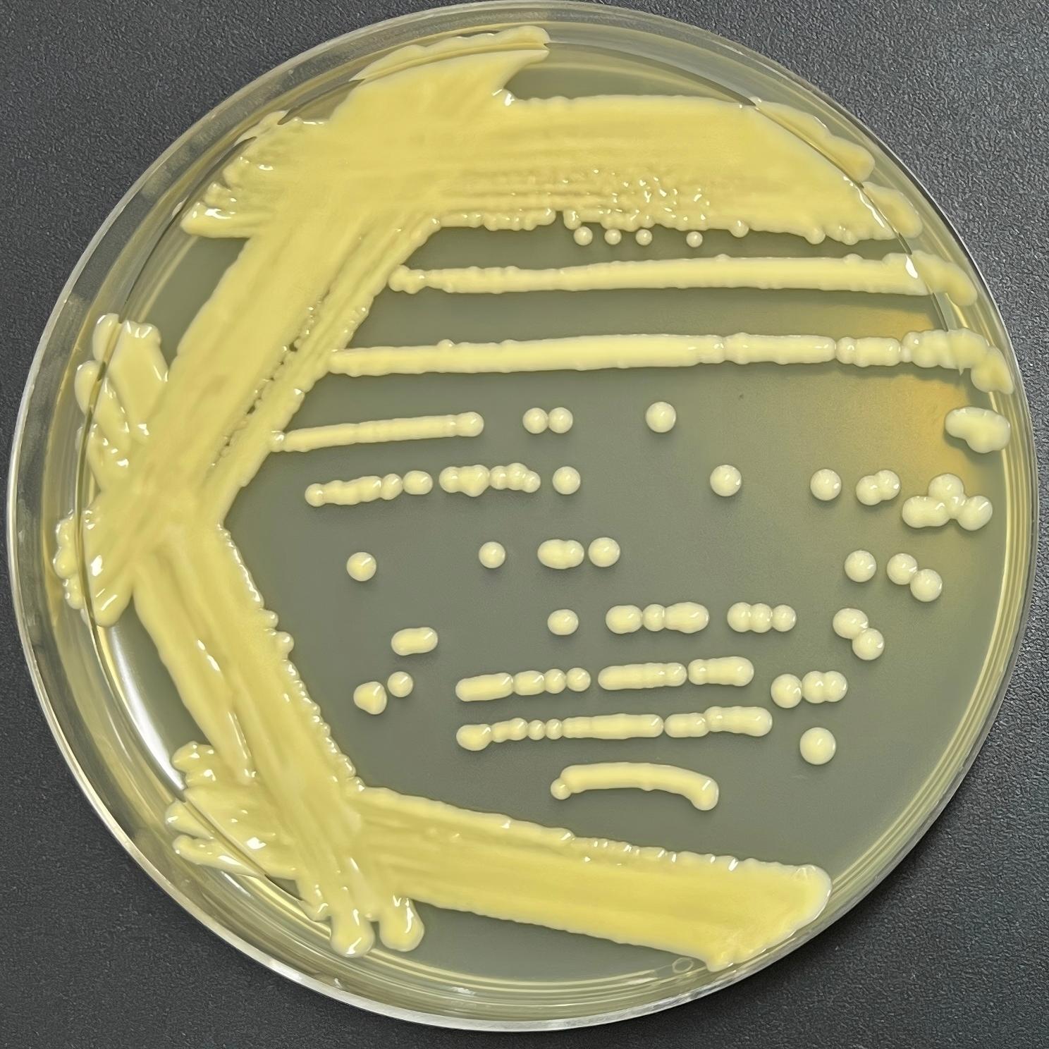 Weishi yeast genus-BNCC