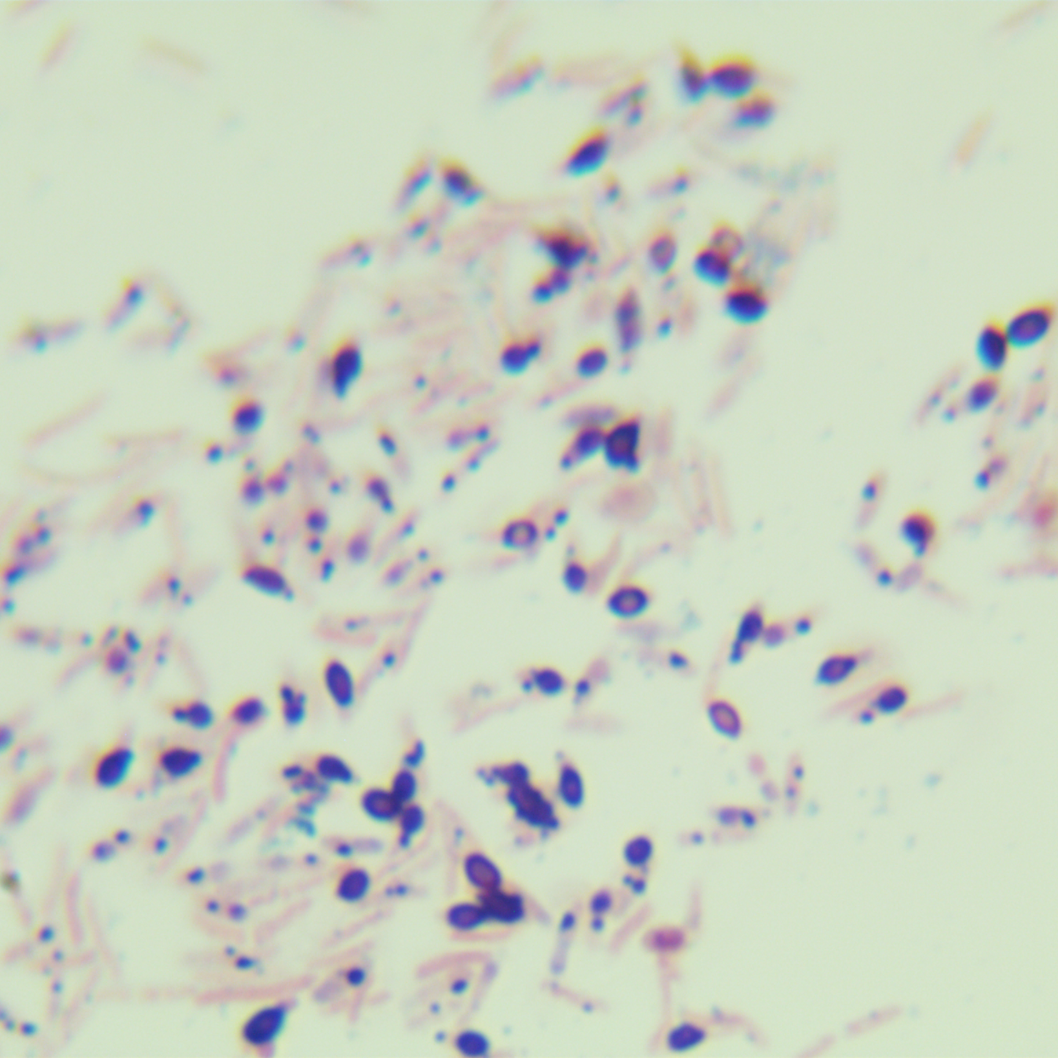 Bacillus subtilis-BNCC
