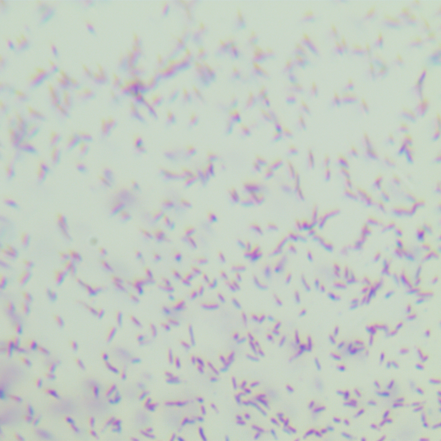Mycobacterium abscesses-BNCC