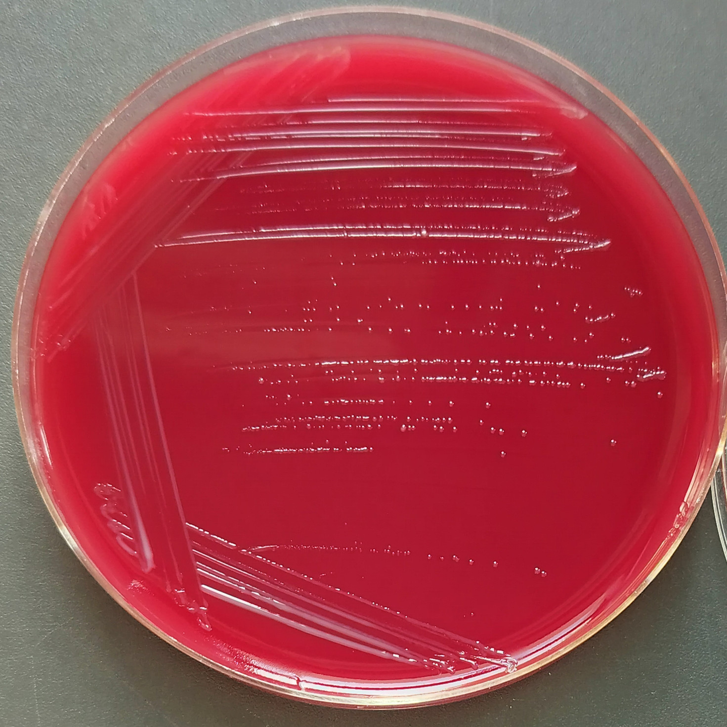 Pseudomonas aeruginosa-BNCC